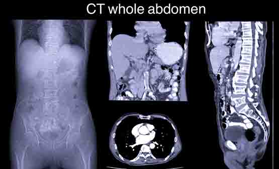 whole abdomen ct scan report in panvel & kharghar navi mumbai