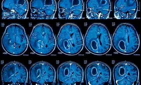 mri reports used in diagnosis joint, heart, brain tumors etc. in panvel & kharghar navimumbai
